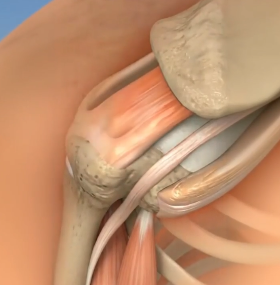 How RestoraCare "TriTherapy" Shoulder Massager Works